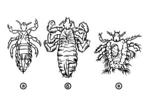 Type of Lice