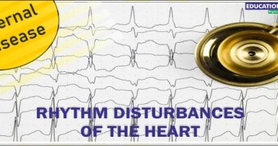 RHYTHM DISTURBANCES OF THE HEART